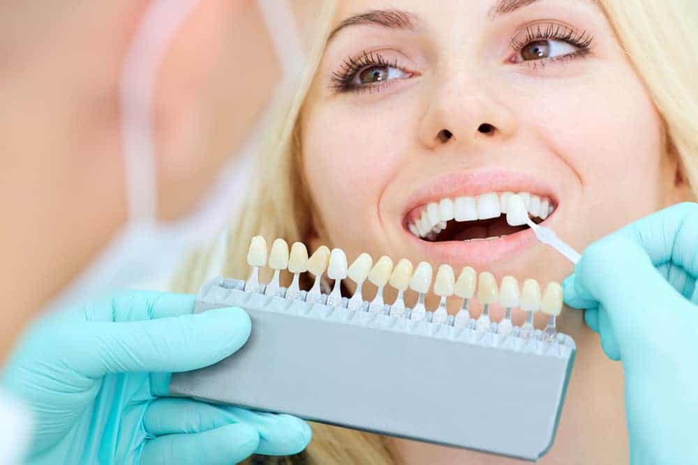 patients veneers have fallen out