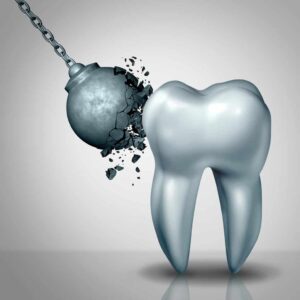 Damage to your enamel